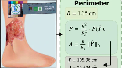 Automated Chronic Wounds Medical Assessment and Tracking Framework Based on Deep Learning featured image
